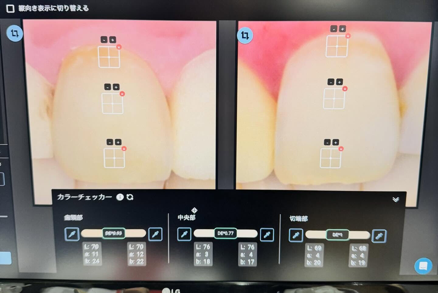 少しずつオプティシェードとマティスに慣れて来ました！