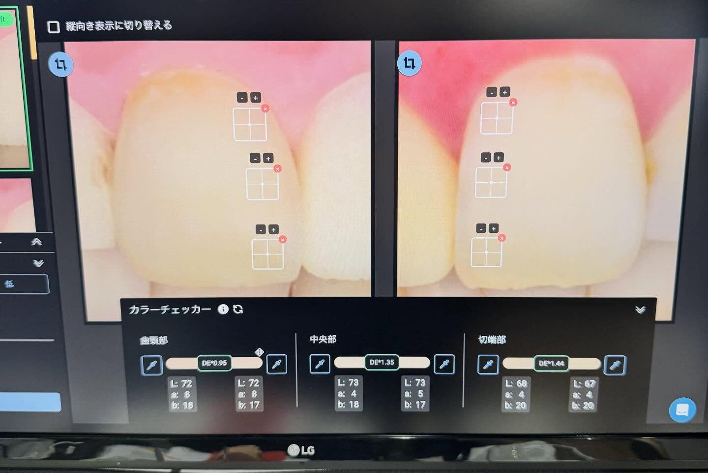 少しずつオプティシェードとマティスに慣れて来ました！