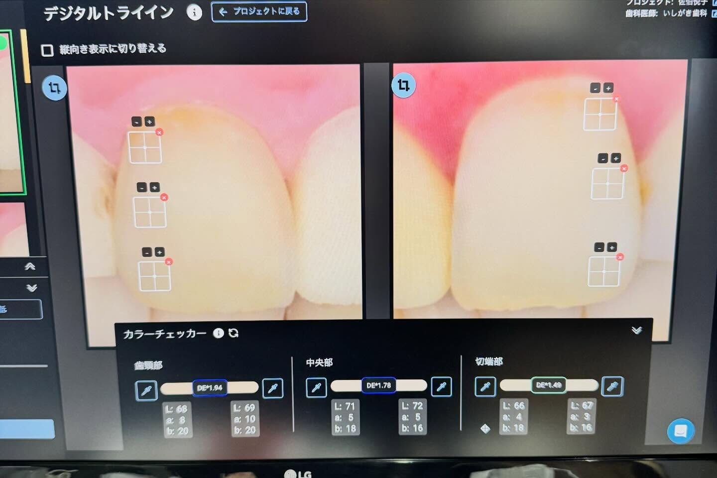 少しずつオプティシェードとマティスに慣れて来ました！